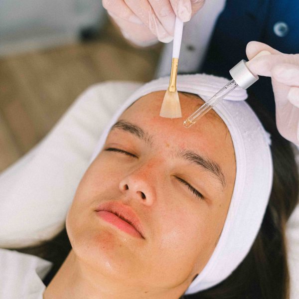 Peeling químico para cicatrices atróficas en Nivillac