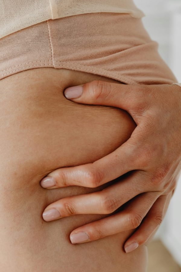 Tratamiento anti celulitis en piernas